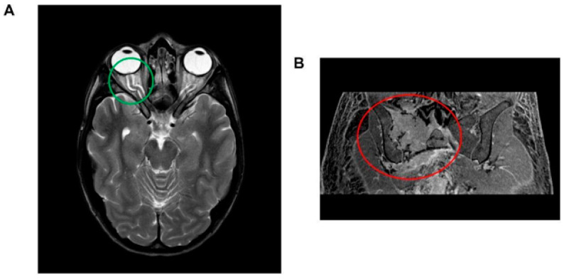 Key image 1