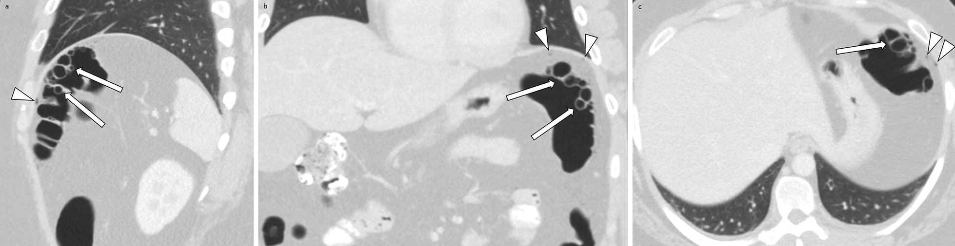 Key image 1