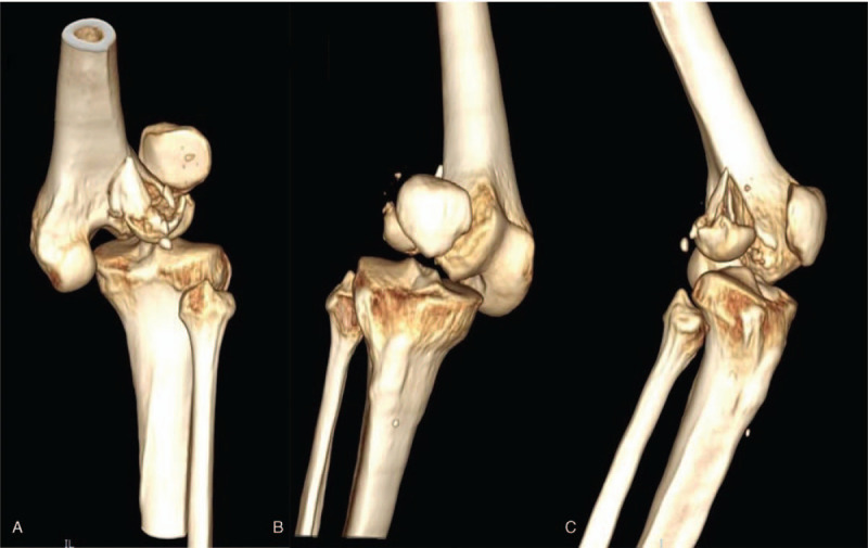 Key image 1