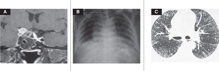 Key image 2
