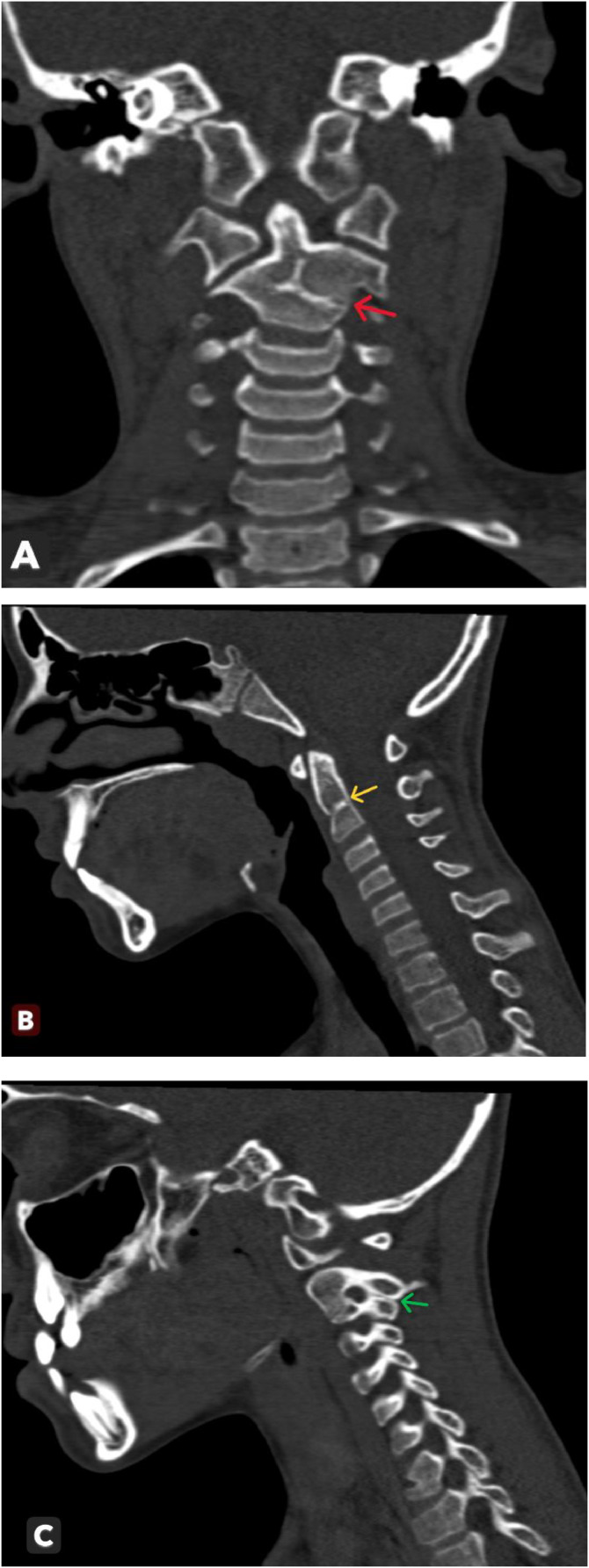 Key image 1