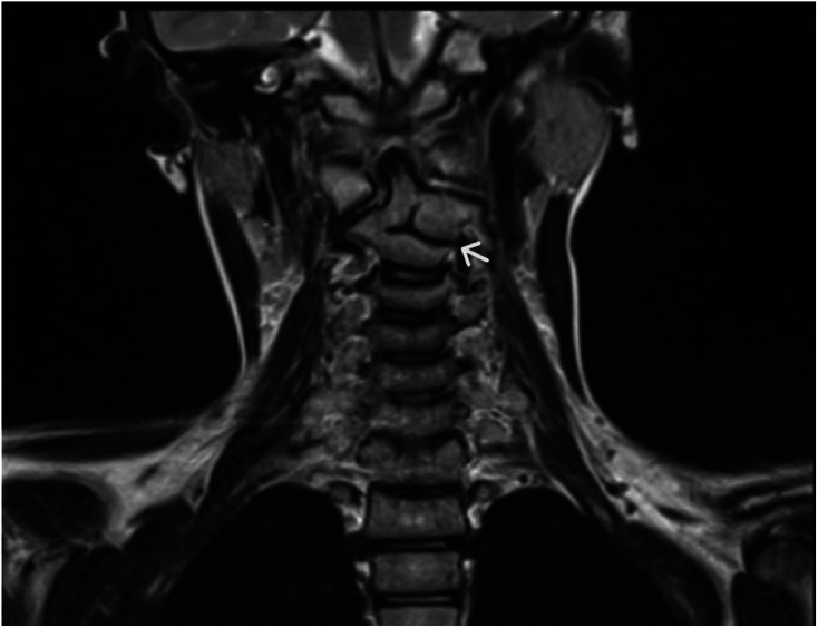 Key image 2