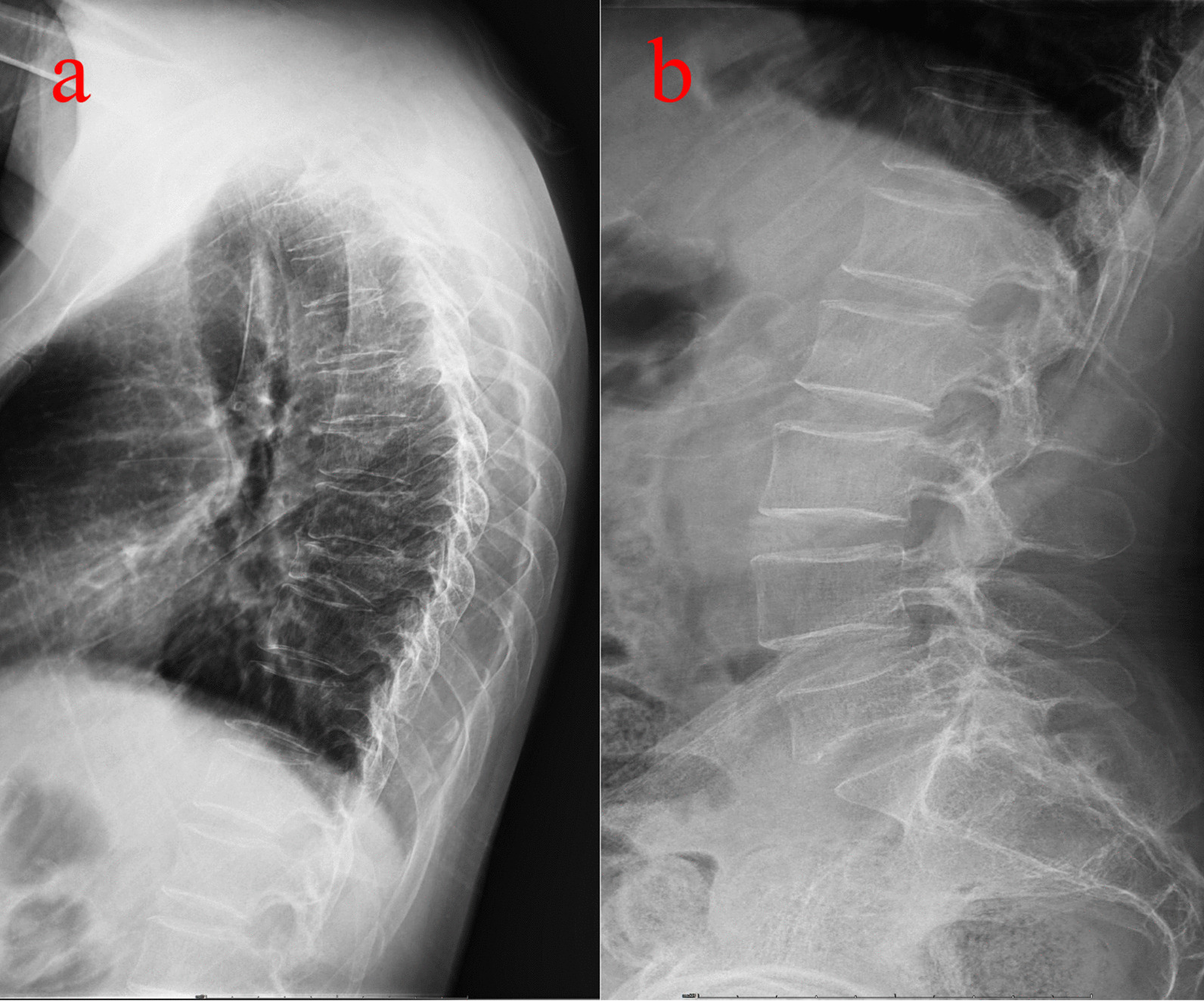 Key image 3
