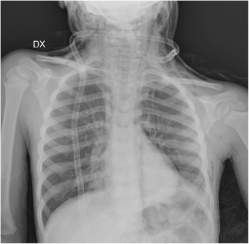 Key image 1