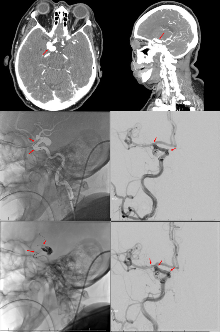 Key image 1