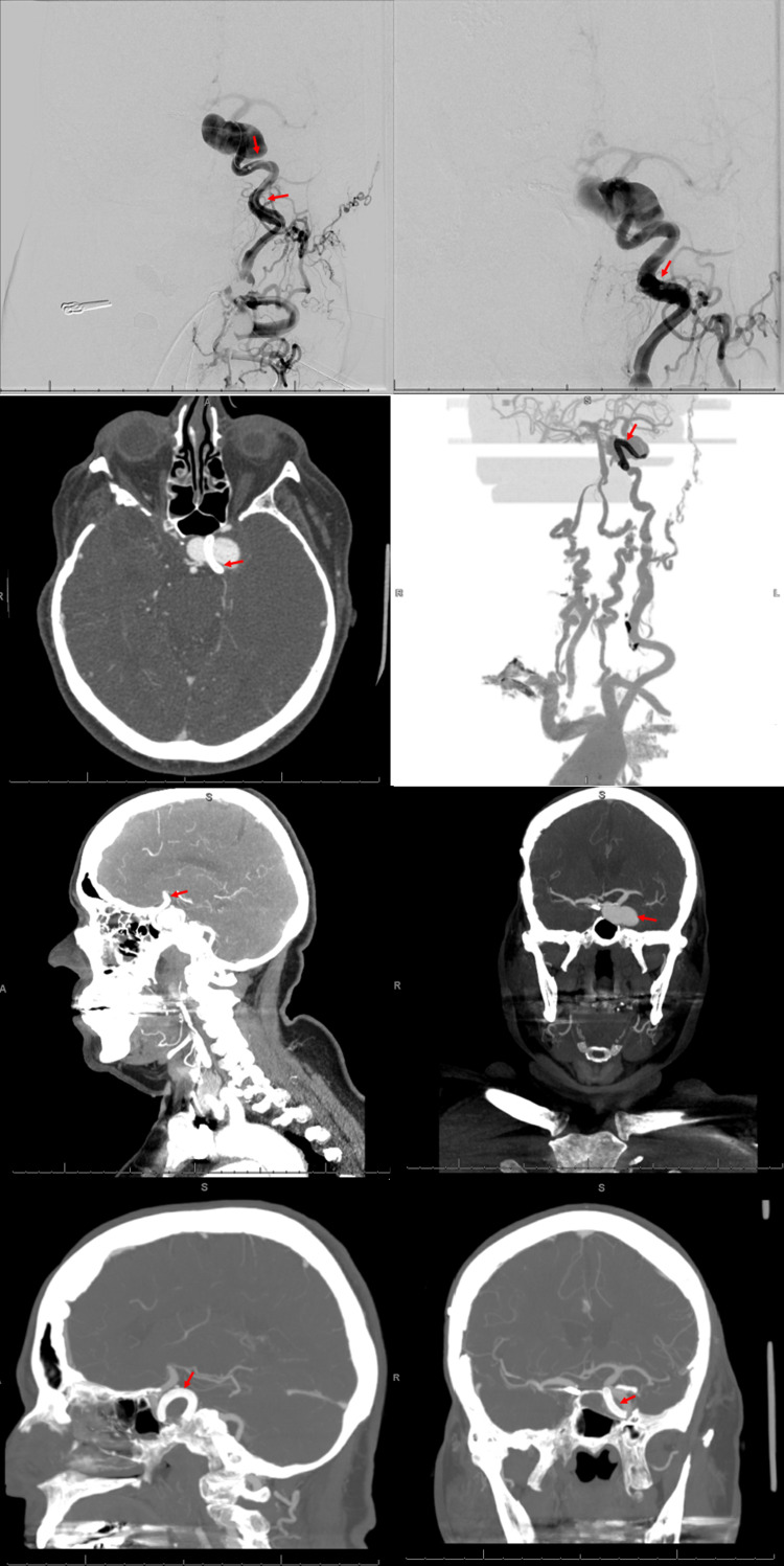 Key image 2