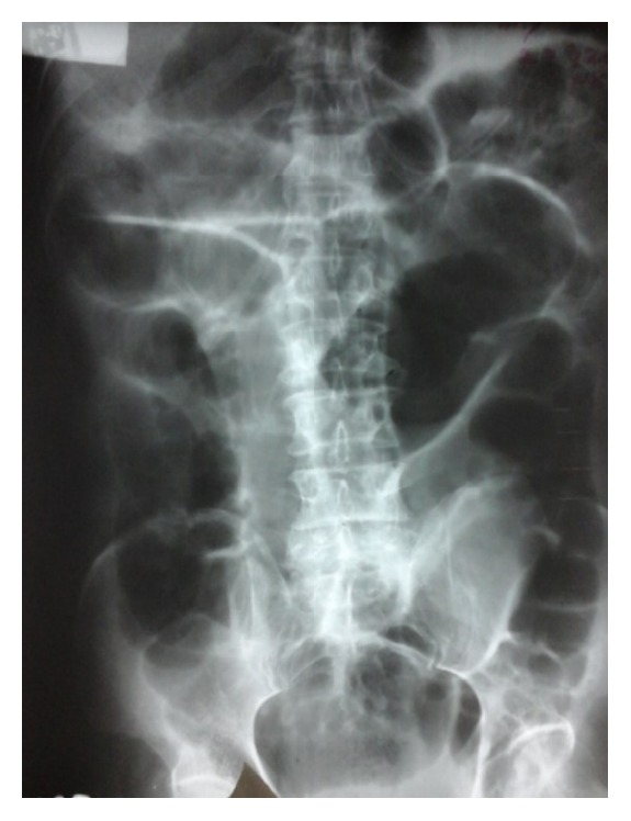 Key image 1