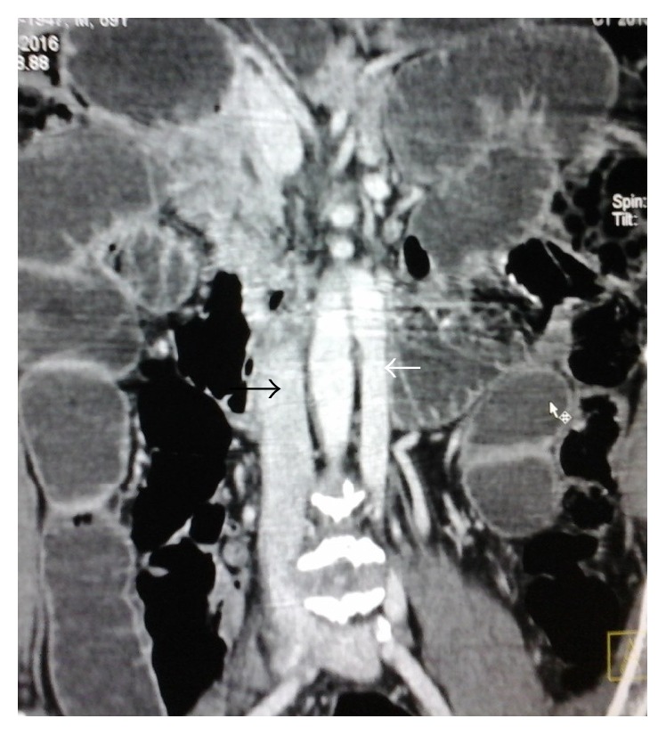 Key image 3