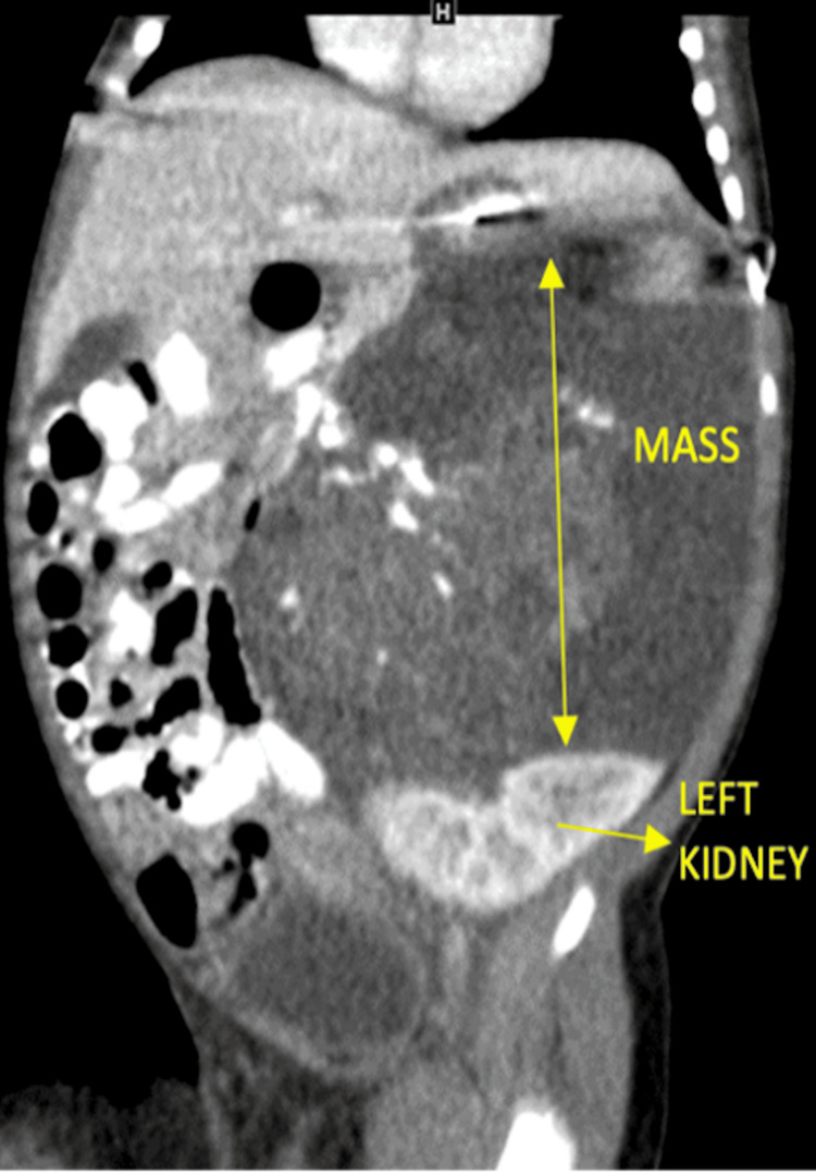 Key image 3
