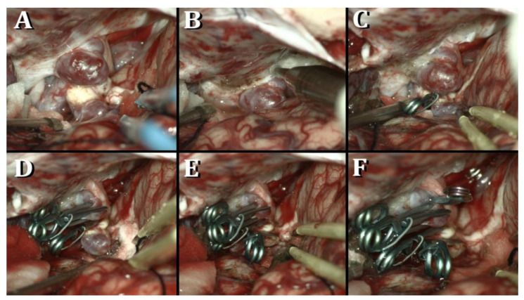 Key image 2