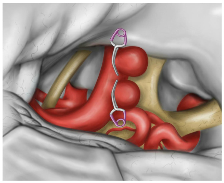 Key image 3