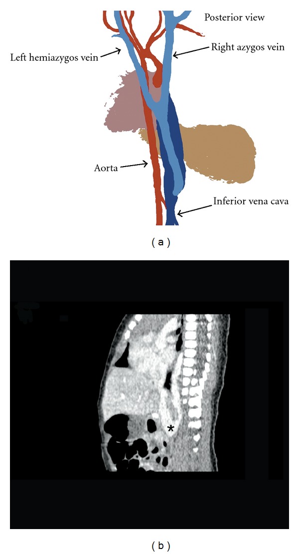 Key image 2