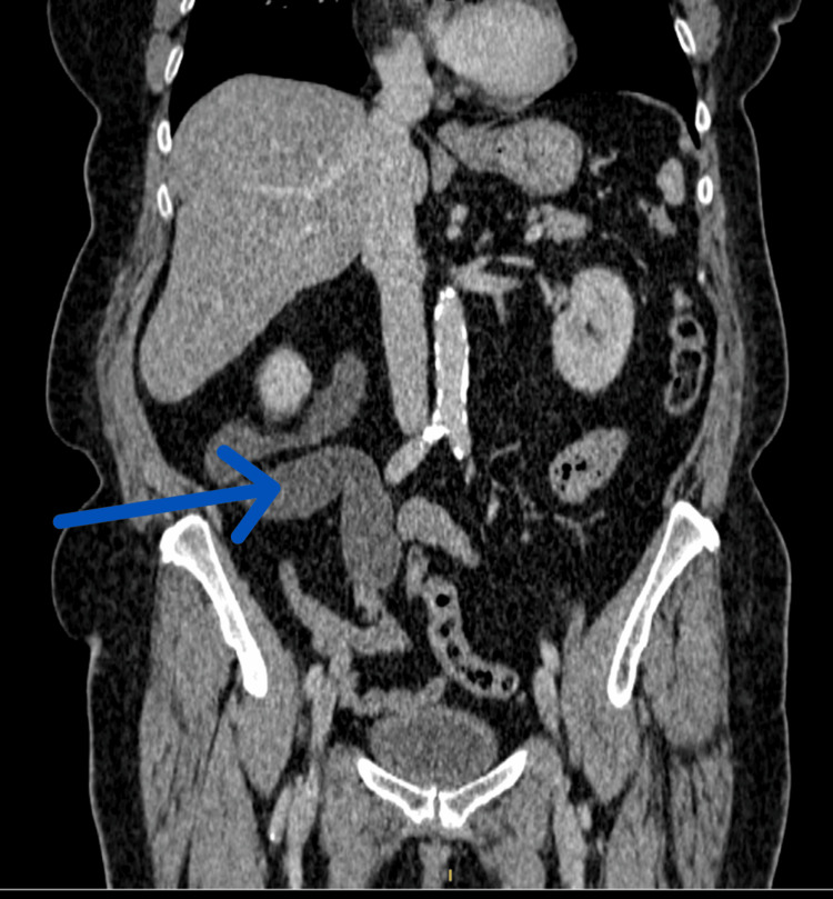 Key image 1