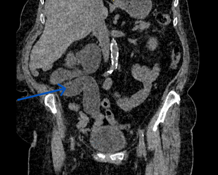 Key image 3