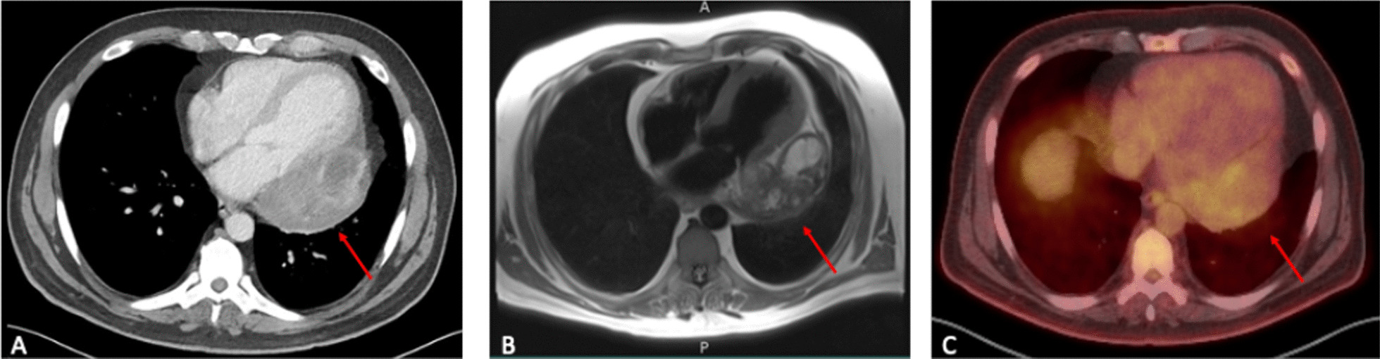 Key image 1