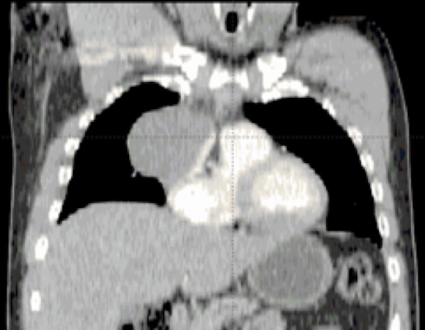 Key image 1