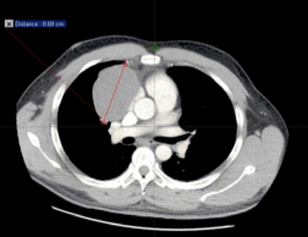 Key image 2