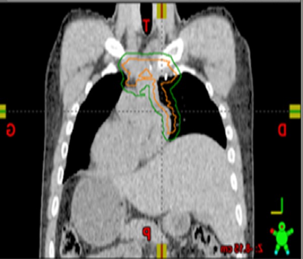 Key image 3