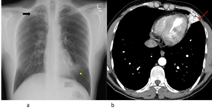 Key image 1