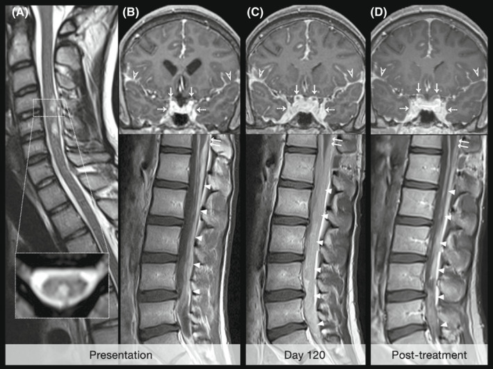 Key image 2