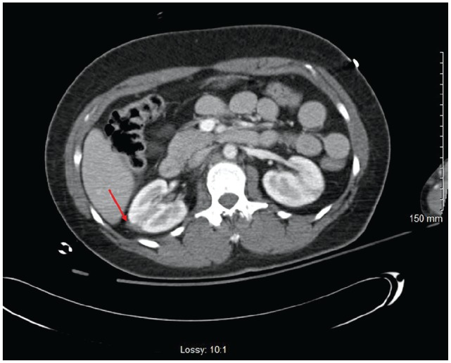 Key image 1