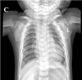 Key image 1
