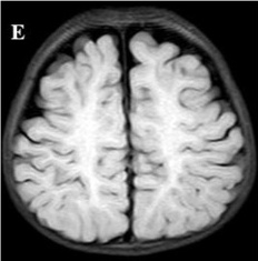 Key image 3