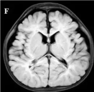 Key image 4