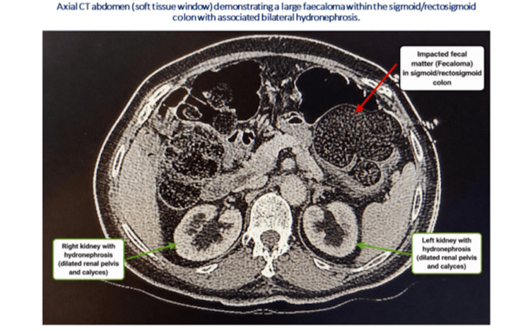 Key image 2