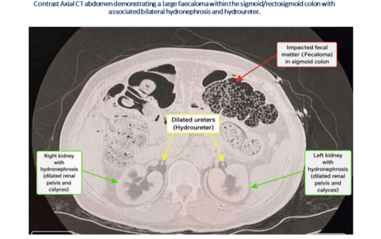 Key image 3