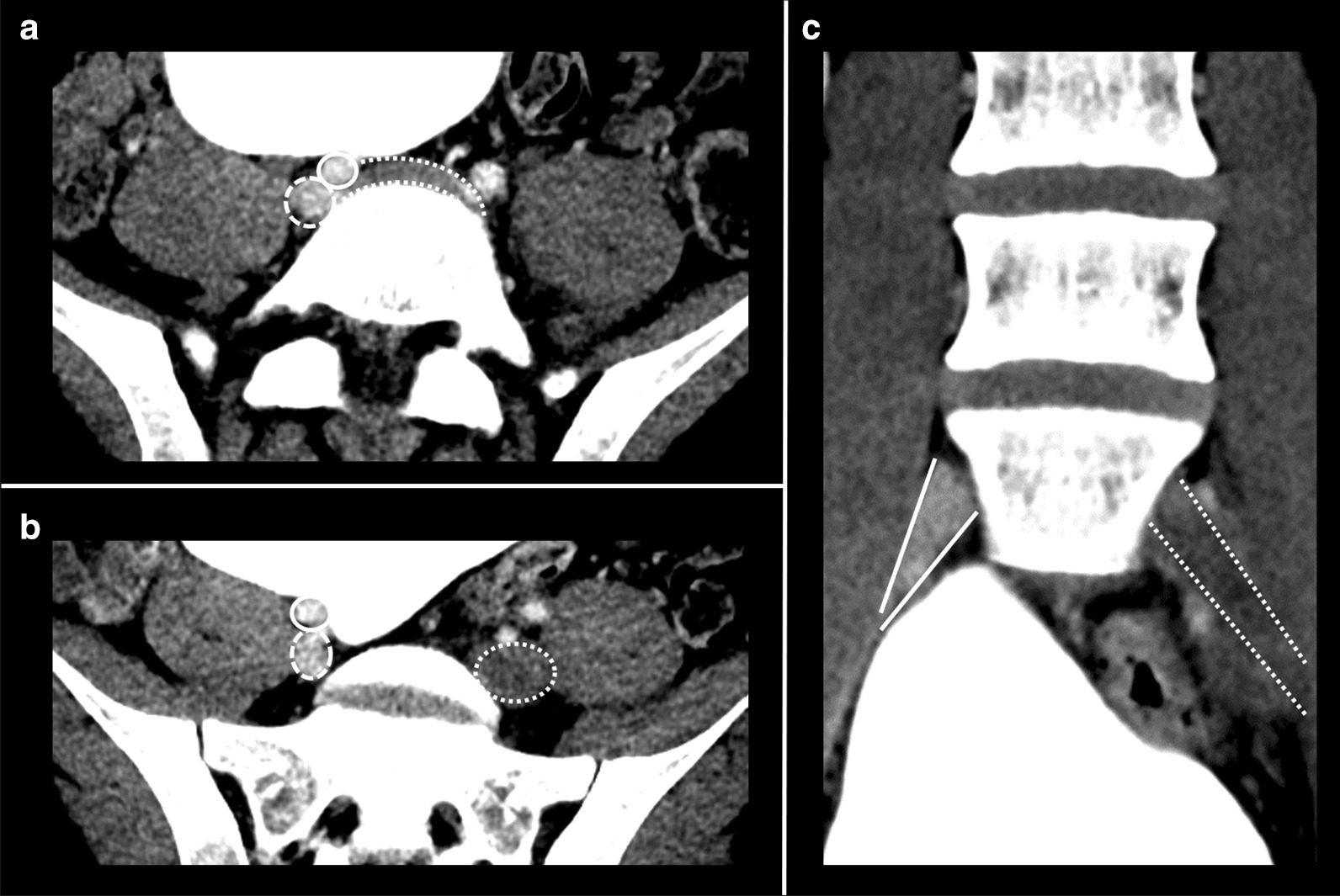 Key image 3
