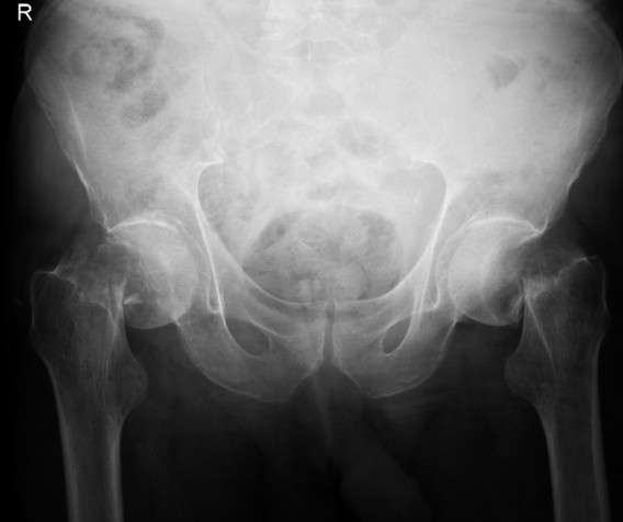 Key image 1