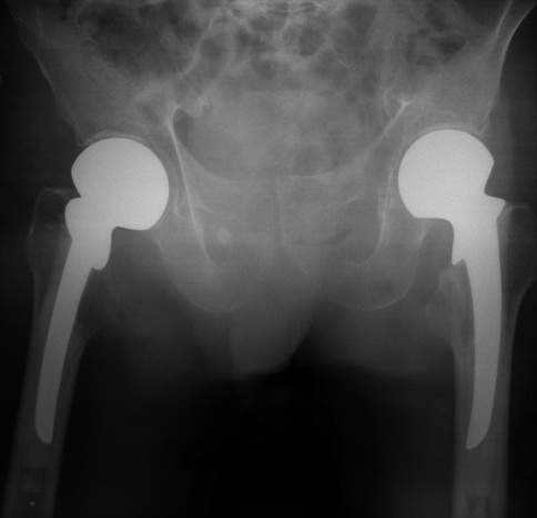 Key image 2