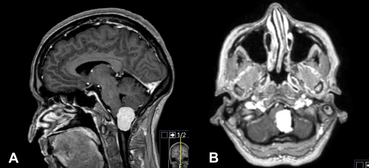 Key image 1