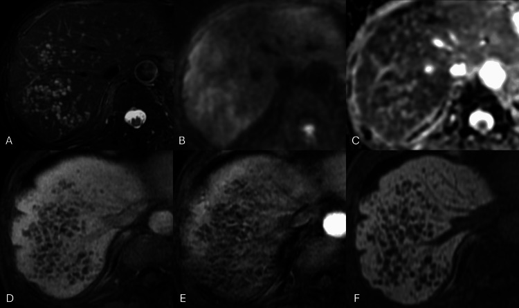 Key image 2