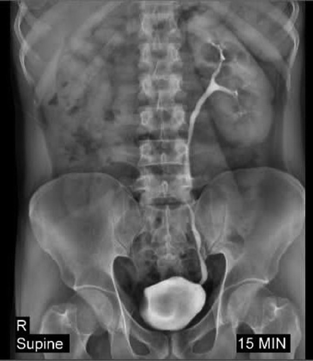 Key image 1