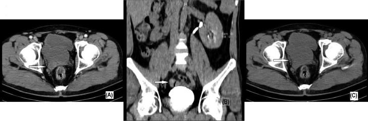 Key image 2