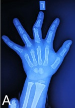 Key image 1