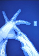 Key image 2