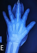 Key image 3