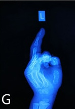 Key image 4