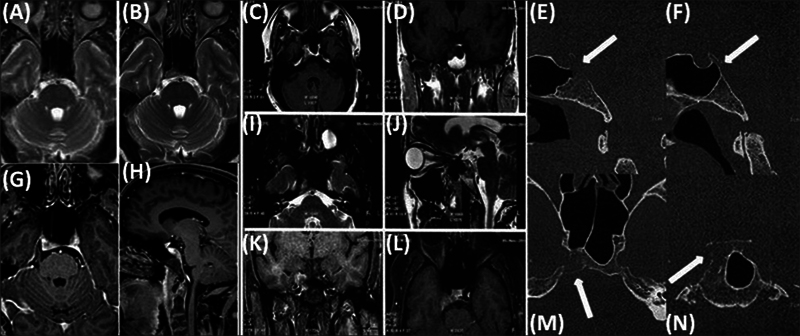 Key image 1