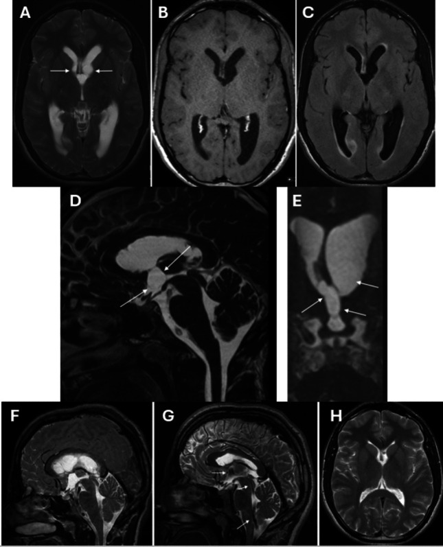 Key image 1