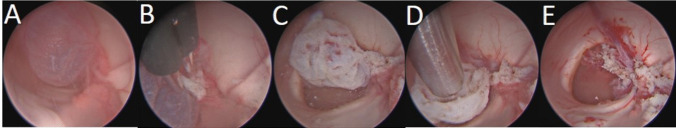 Key image 2