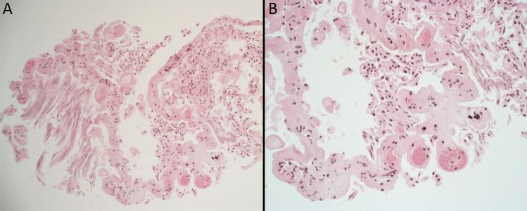 Key image 3