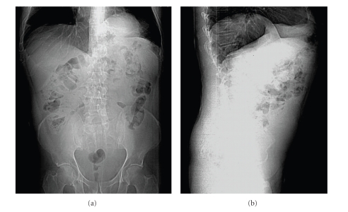 Key image 1