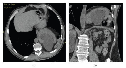 Key image 3