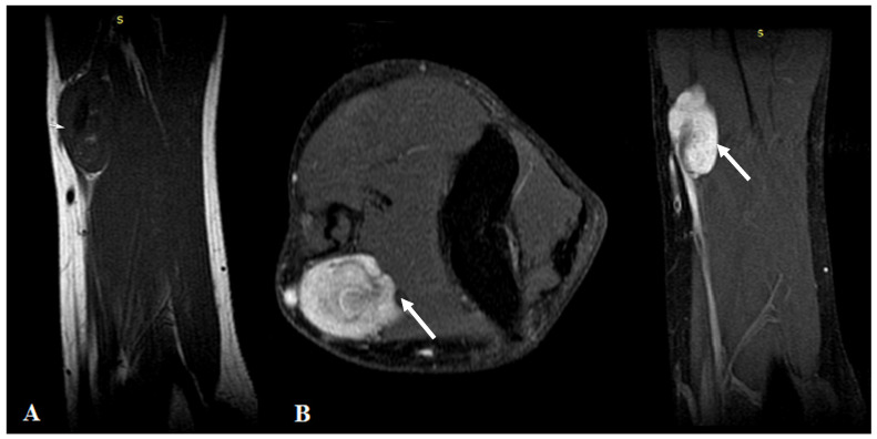 Key image 1