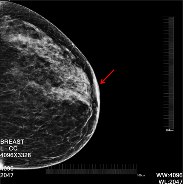 Key image 1