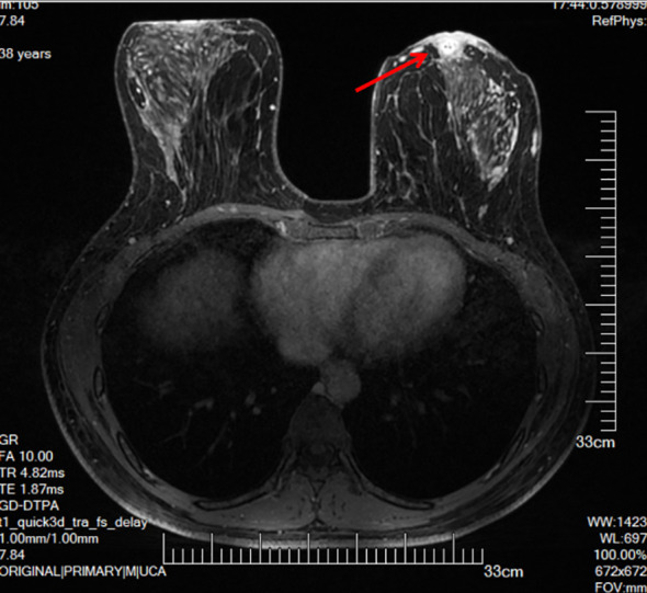 Key image 2